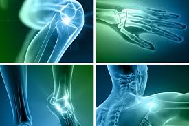 Orthopedics